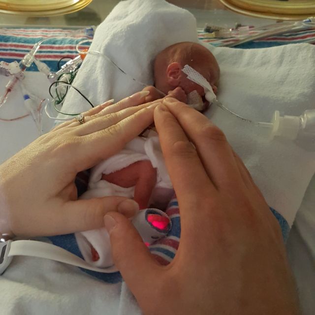As Fotos Que Retratam A Longa Batalha De Bebe Que Nasceu Com 310 Gramas Para Deixar O Hospital c News Brasil