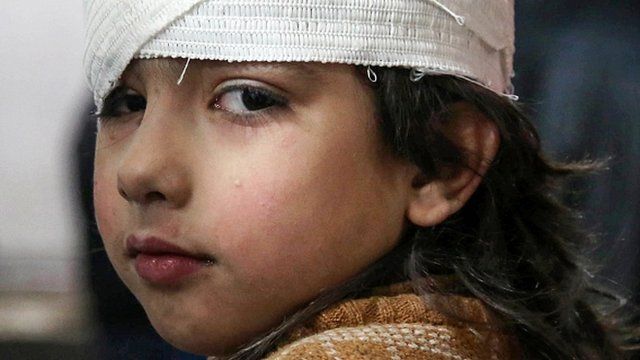 Children hurt in siege of Eastern Ghouta