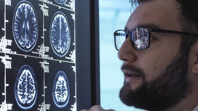 Un doctor examina imágenes escaneadas de un cerebro