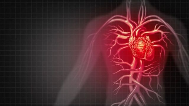 心血管疾病仍是人类健康的主要杀手之一。(photo:BBC)
