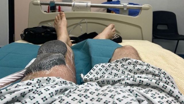 नेक्रोटाइजिङ्ग फ्यासिआइटिस