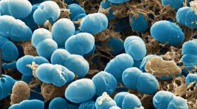 เชื้อแบคทีเรีย Staphylococcus epidermidis จำนวนมาก อาศัยอยู่บนผิวหนังของมนุษย์ทุกคน