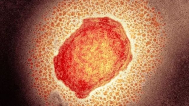 Partícula do vírus da varíola dos macacos