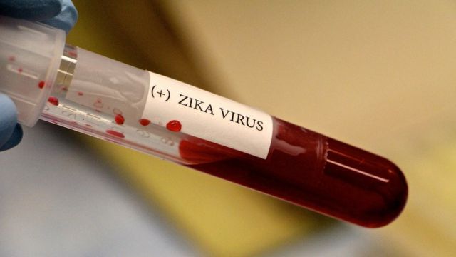 Amostra de sangue com etiqueta zika