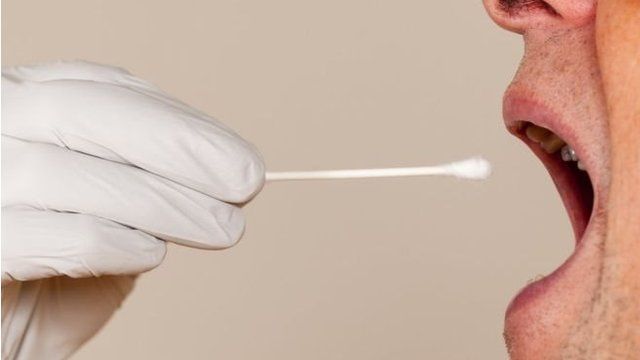 预防前列腺癌 唾液检测可快速识别高危基因 c News 中文