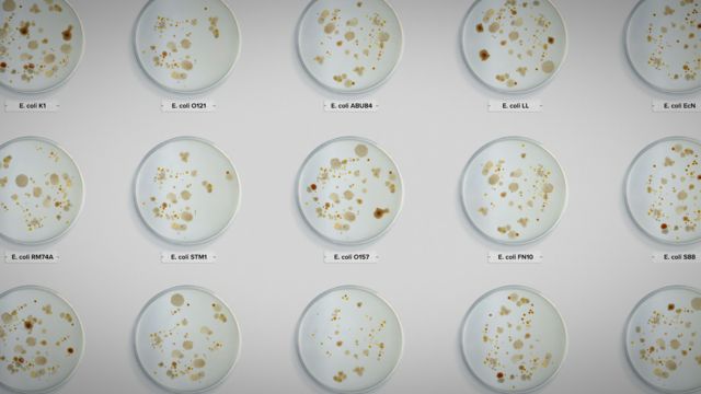 Pratos contendo vários tipos de bactérias E. coli