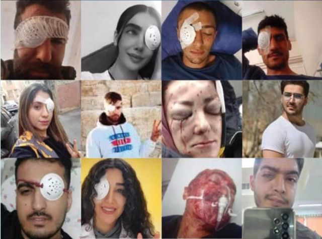 سازمان حقوق بشر ایران در گزارشی، اسامی و تصاویر تعدادی از کسانی که در جریان اعتراض‌ها به چشم‌هایشان آسیب وارد شده بود را منتشر کرد