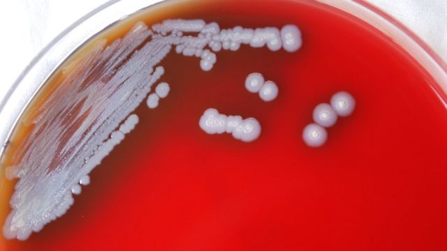 Cultivo de bacteria en una placa de laboratorio