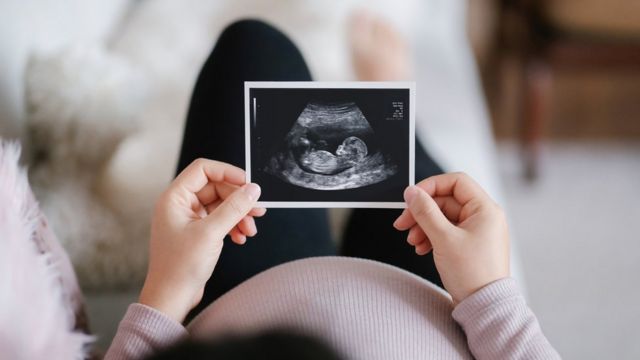 Desenho para Bebe, Indo para o Médico, Canções para Bebe