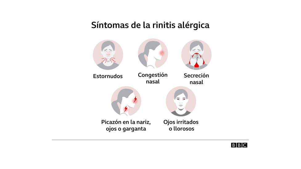 Síntomas de alergia