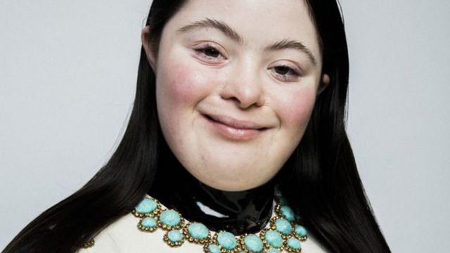 Quién es Ellie Goldstein, la primera modelo con síndrome de Down en  aparecer en Vogue - BBC News Mundo