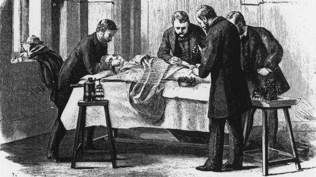 Una ilustración de una cirugía alrededor de 1860