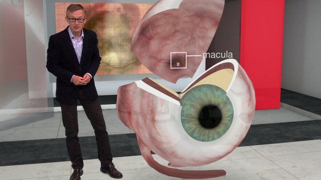 Fergus Walsh explains what causes age-related macular degeneration