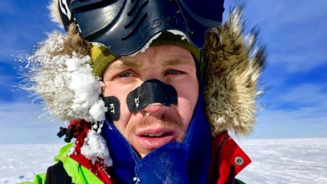 O'Brady wore tape on his face to stave off frostbite
