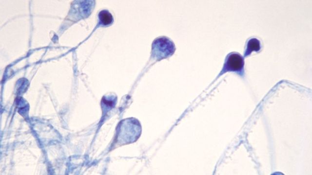 Fotomicrografia revela vários esporângios jovens de uma mucormicose