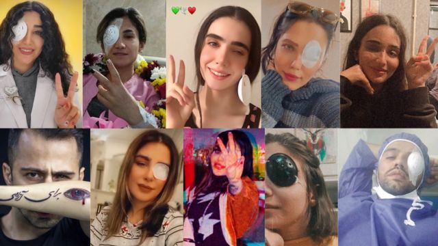 A photo montage of 10 Iranians with injured eyes and many making the victory sign with their fingers