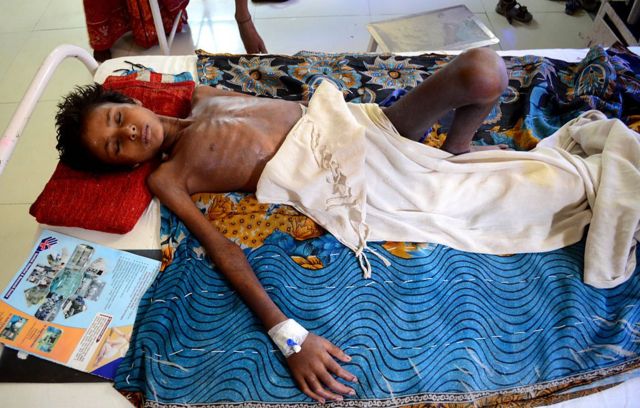 பசி குறியீட்டு அறிக்கையில் 111வது இடத்தில் இந்தியா: சர்ச்சையான ஸ்மிருதி இராணியின் கருத்து