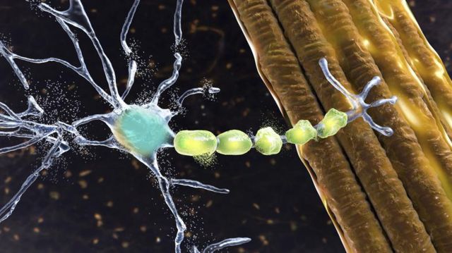 A esclerose lateral amiotrófica afeta as células nervosas que controlam os movimentos voluntários dos músculos – os chamados neurônios motores