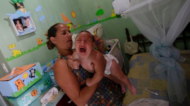 ブラジルでは小頭症の赤ちゃんが増加している