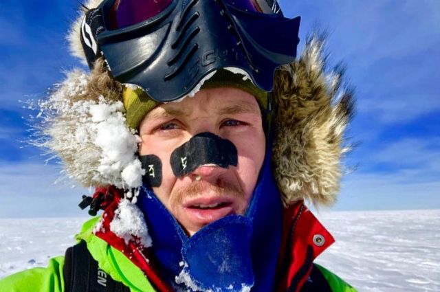 O'Brady wore tape on his face to stave off frostbite