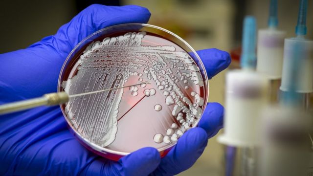 Bacterial growth