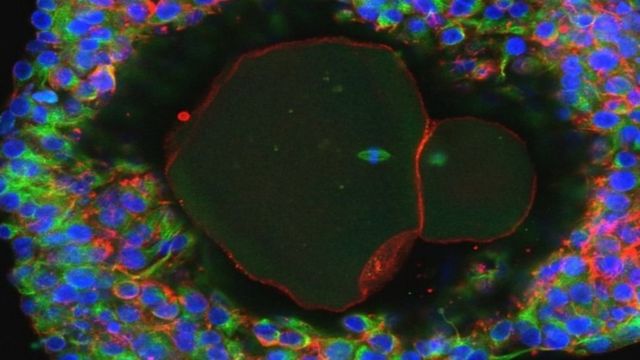 Pela primeira vez, cientistas criam embrião metade humano, metade