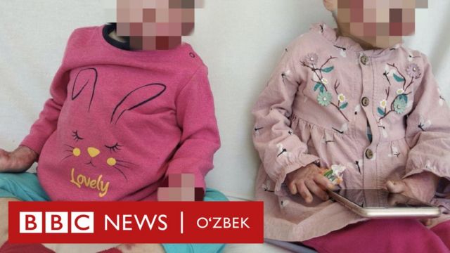Сурум фожеасида ногирон бўлган болалар