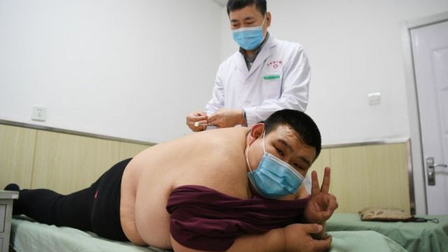 मोटे लोगों के लिए क्या कोरोना वायरस ज़्यादा जानलेवा है? - BBC News हिंदी