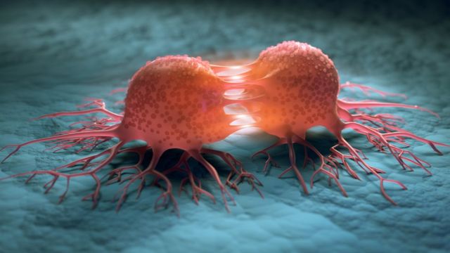 Araştırma: Kanser oluşmadan on yıllar önce tespit edilebilir - BBC News Türkçe