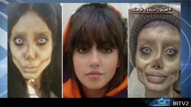 Screenshot of Iranian TV broadcast showing Sahar Tabar before and after plastic surgery