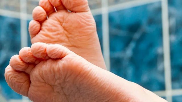 விரல் சுருக்கங்கள்