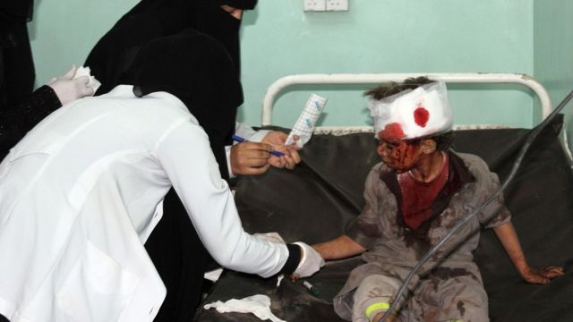 صبي يمني يتلقى العلاج في المستشفى