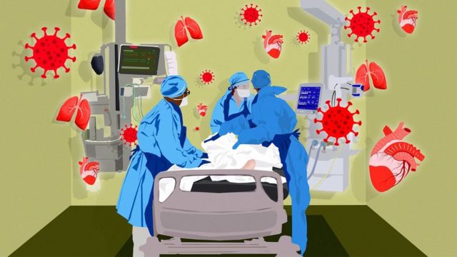 Ilustração de pessoa em leito de hospital, ao lado de três profissionais de saúde e aparelhos