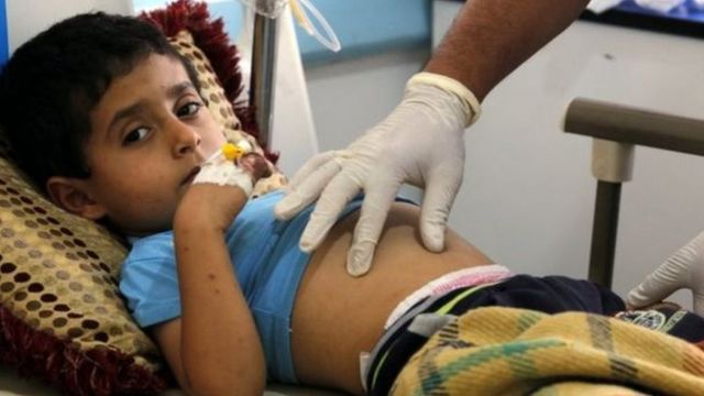 ربع الوفيات بسبب الكوليرا من الأطفال