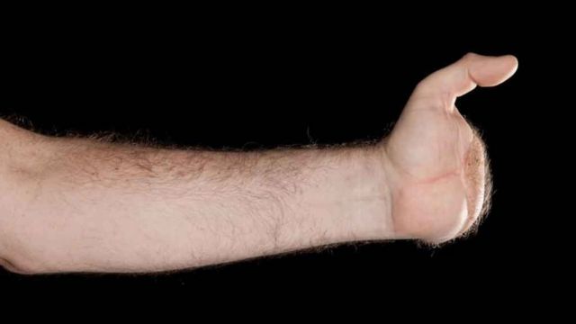 В Британии впервые проведена пересадка кистей обеих рук - BBC News ...
