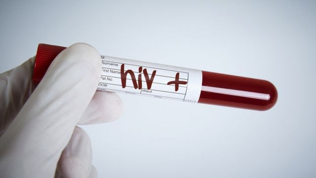 Una probeta con HIV +.