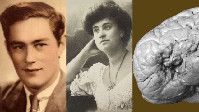 H.M., Dora y el cerebro de Monsieur Leborgne