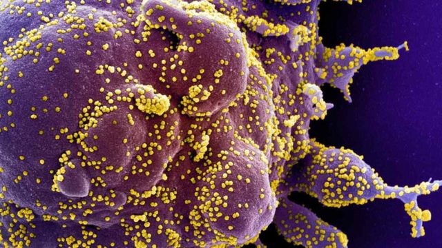 Клетка человеческого организма, пораженная коронавирусом