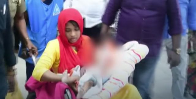 சென்னை, மருத்துவமனை, குழந்தை, கை அகற்றம்