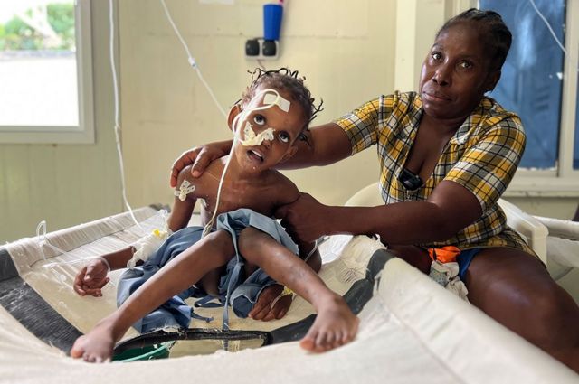 Menina em um centro de tratamento de cólera