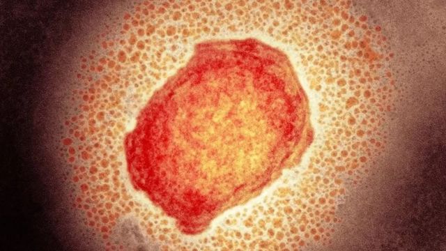 Partícula do vírus da varíola do macaco