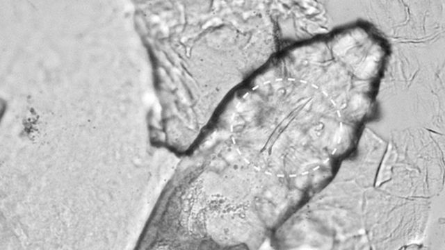 Imagem microscópica do ácaro