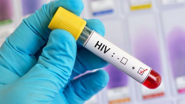 HIV-positive blood