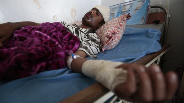 A man lies in a hospital bed after he was injured in Saudi-led airstrikes targeting a funeral hall, in Sanaa, Yemen
