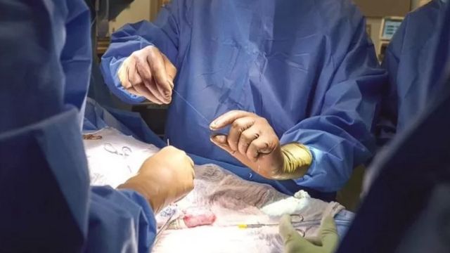 சிறுநீரக மாற்று அறுவை சிகிச்சை