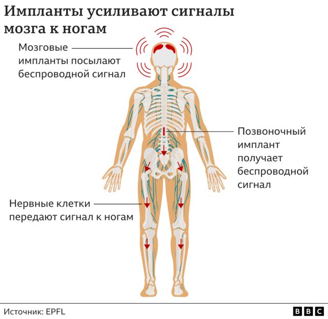 Как проходит операция?