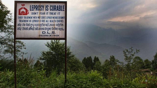 Placa em que se lê 'hanseníase tem cura'