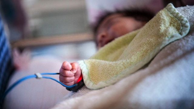 Un oxímetro controla los niveles de oxigenación en la sangre de un bebé en Francia.