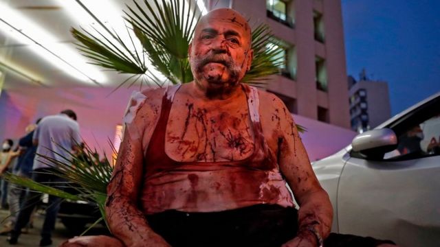 пострадавший