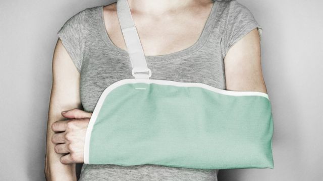 Mujer con el brazo inmovilizado